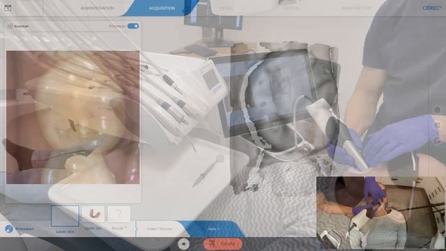 CEREC Primescan - digitaaliset mallit смотреть онлайн