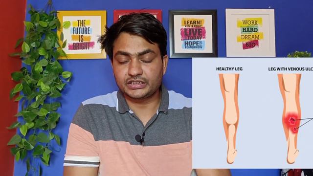 daflon 500 mg tablet use in hindi | daflon 1000 mg tablet use in hindi смотреть онлайн