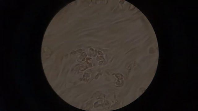 Кровь после сухариков. А вы часто их едите? смотреть онлайн