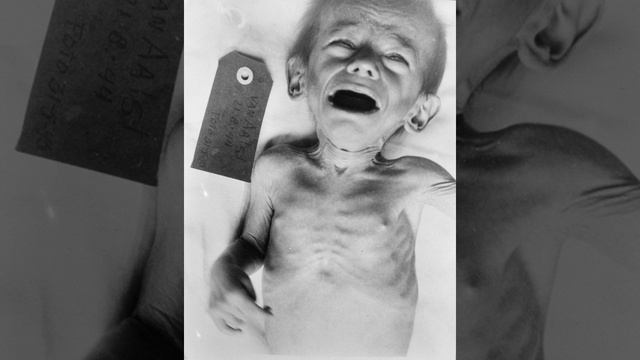 Famine | Wikipedia audio article смотреть онлайн