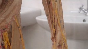 Нервы и мышцы верхней конечности на сосудисто нервном трупе