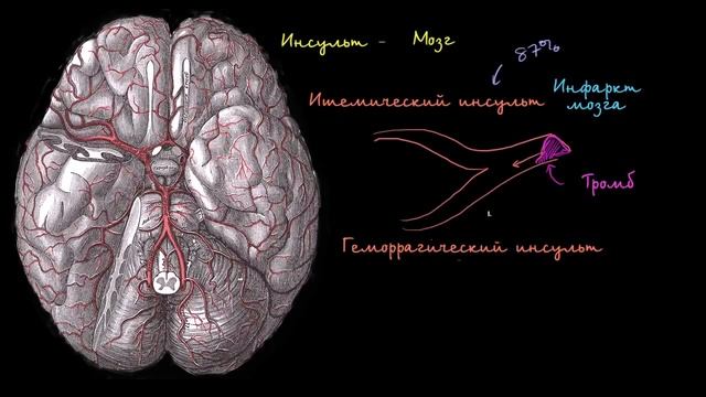 ИНСУЛЬТ.ПОДРОБНАЯ СХЕМА.КАК.ОТ ЧЕГО.ГДЕ.ПОЧЕМУ.КАК ПРОТЕКАЕТ.И ПРИЧИНЫ ВОЗНИКНОВЕНИЯ, ПРОСТЫМ ЯЗЫКО смотреть онлайн