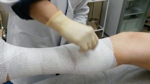 Лечение трофической язвы цинковый бинт вароласт.