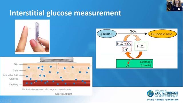 NACFC 2020 | Discipline Group 11: Cystic Fibrosis Related Diabetes 2.0 смотреть онлайн