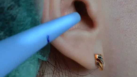 Серная пробка. Удаление в домашних условиях. Бусел О.И.