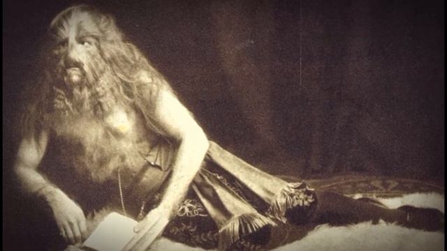 Самые ВОЛОСАТЫЕ люди:ГИПЕРТРИХОЗ или синдром АМБРАСА смотреть онлайн