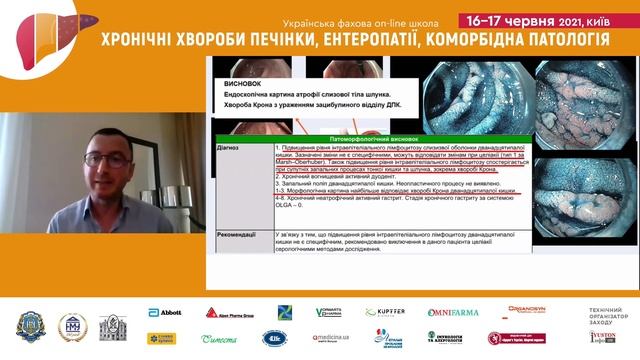 Ендоскопічні та патогістологічні паралелі у пацієнта з ураженням тонкої кишки. смотреть онлайн