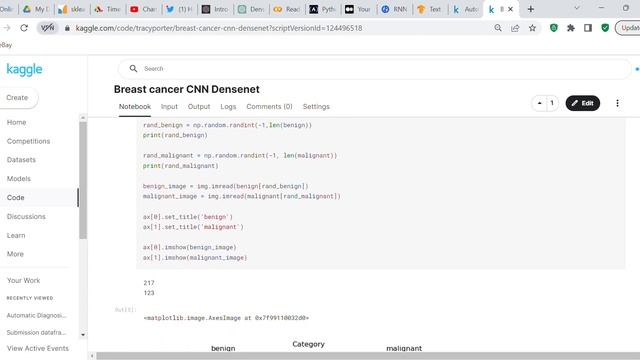 Code Review: Kaggle community competition on Breast cancer ultrasound images смотреть онлайн