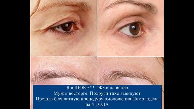 Миндальный Пилинг [Миндальный Пилинг] смотреть онлайн