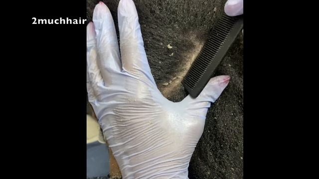 What's Inside This Puff? Dandruff Addiction