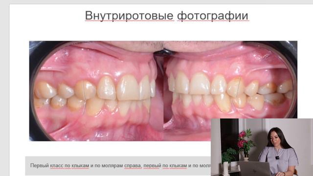 Анализ клинического случая №4 смотреть онлайн
