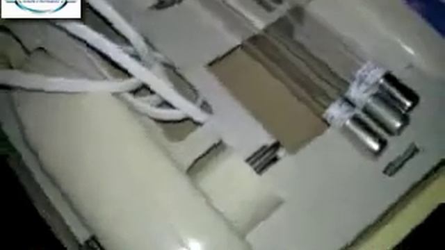 Комплектация Дарсонваль Корона в Кишиневе смотреть онлайн