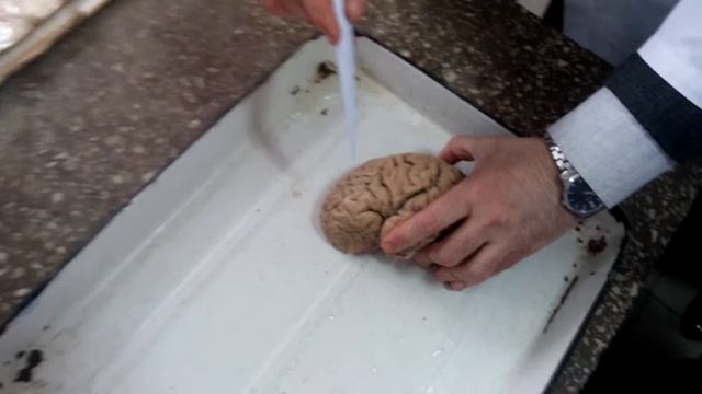 Анатомия конечный мозг внешнее строение смотреть онлайн