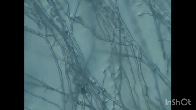 Цвілевий гриб Мукор | Mold Fungus Mucor, Mycelium In The Substrate Under A Microscope