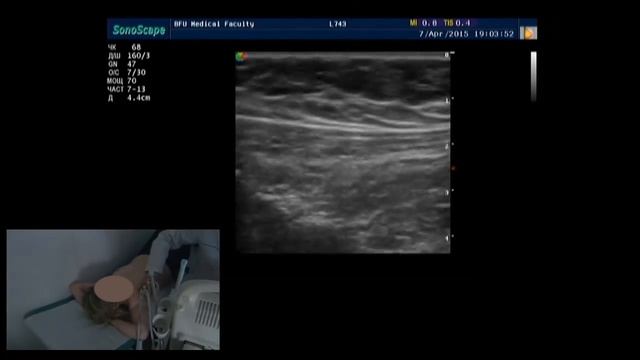 Практическое занятие: УЗИ молочных желез смотреть онлайн