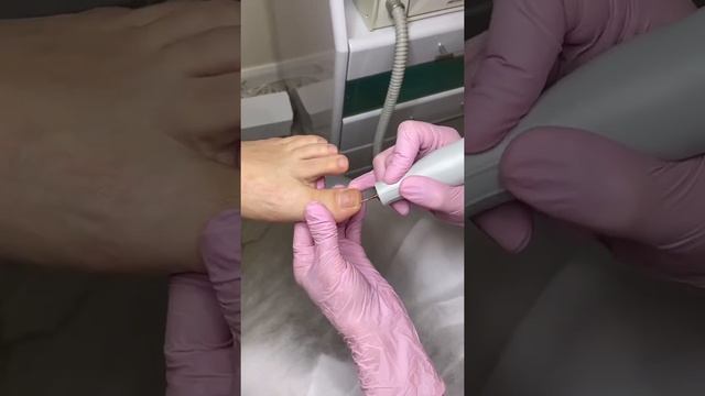 Педикюр у подолога смотреть онлайн