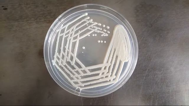 Candida albicans growth on SDA смотреть онлайн