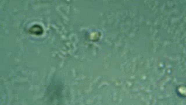 Вода из лужи. Увеличение 400х.3gp смотреть онлайн