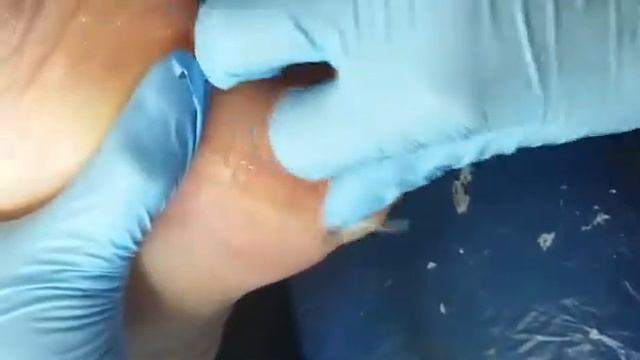 Терапевтичен педикюр смотреть онлайн