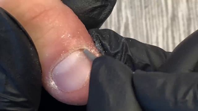 ногти грызуна. преображение. обкусанные ногти/часть 1 смотреть онлайн