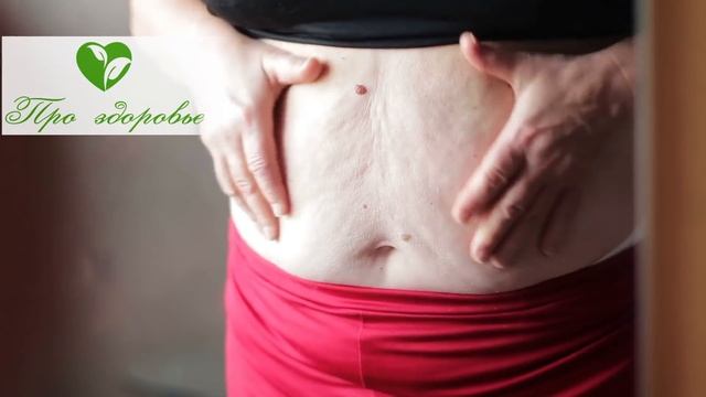 Вдовий горбик исчез! Смотрите, что делают старые ревматологи для удаления холки смотреть онлайн