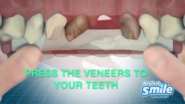виниры perfect smile veneers, красивые зубы быстро, зуб протезирование смотреть онлайн