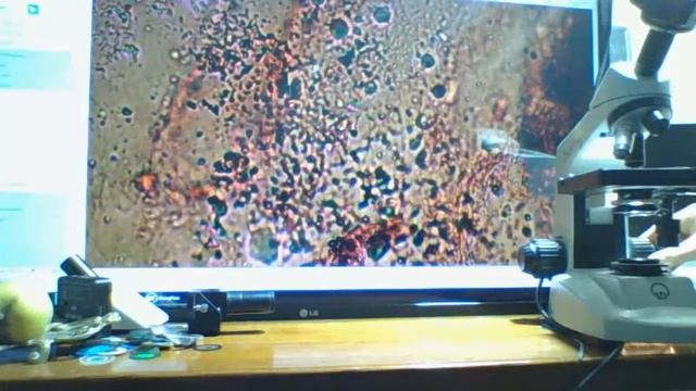 Конфокальные объективы для Микроскопа, виды объективов, посадочные диаметры. Seilwurm Labor