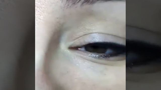 Исправление неудачного татуажа век смотреть онлайн