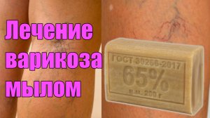 Лечение варикоза хозяйственным мылом! Народное средство проверенное временем!