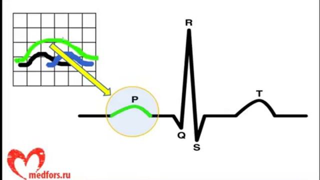 Урок 2  Видеокурс  ЭКГ под силу каждому