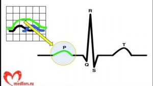 Урок 2  Видеокурс  ЭКГ под силу каждому