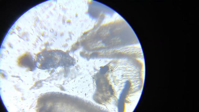 Грунт венерины мухоловки под микроскопом смотреть онлайн