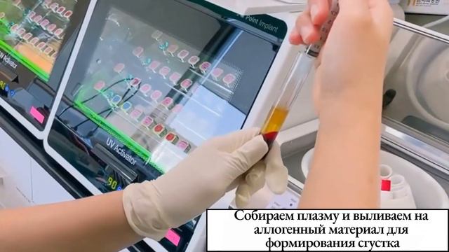 Применение PRF-мембраны | Стоматология МУН | г. Чхонан смотреть онлайн