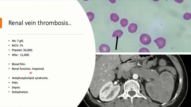 MRCPCH Fundamentals Course. Pediatric hematology 9 смотреть онлайн