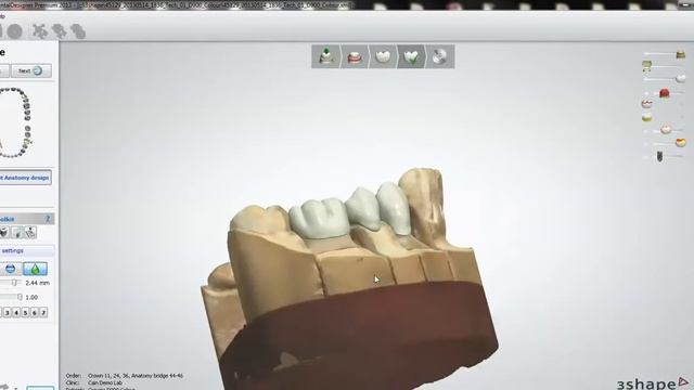 3Shape D900 Dental Scanner смотреть онлайн
