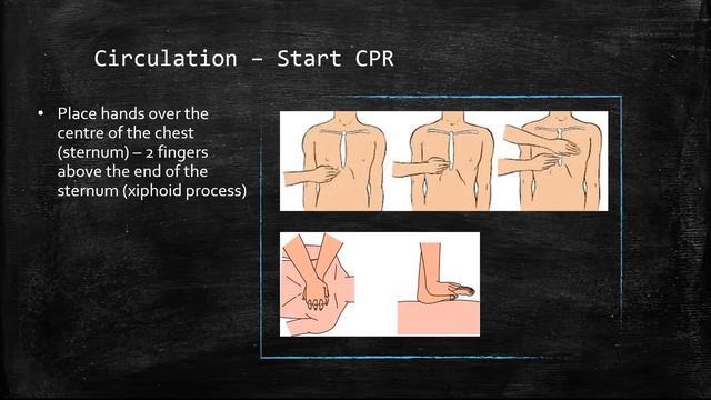 Basic Life Support (BLS) | Step by step | Details смотреть онлайн