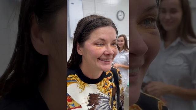 До и через 7 дней после круговой блефаропластики смотреть онлайн