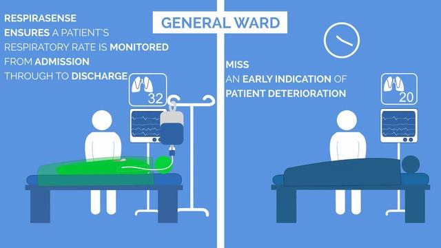 RespiraSense Early intervention from respiratory rate trend monitoring Version 2 2017 смотреть онлайн