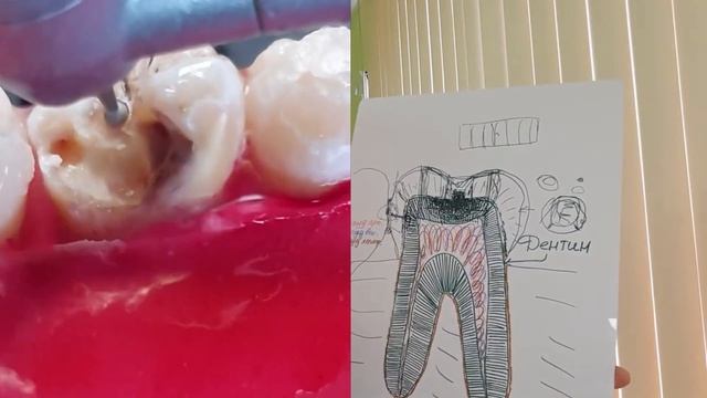 Как избежать КАРИЕСА! смотреть онлайн