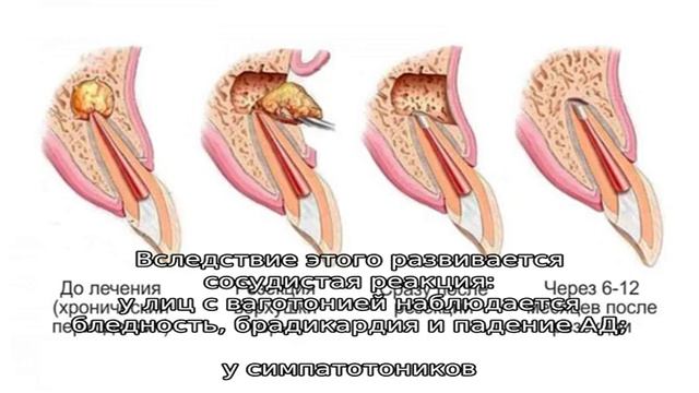 Все о демпинг-синдроме и его лечении