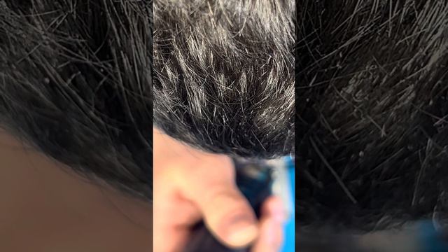 Xiaomi Poco M3 начал тормозить и пропала связь, не включается после перезагрузки смотреть онлайн