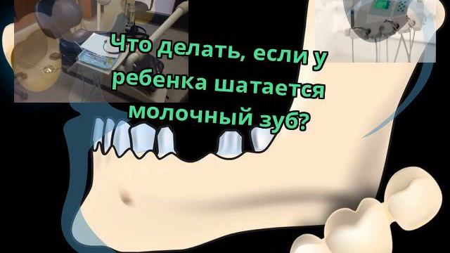 Что делать, если у ребенка шатается молочный зуб? смотреть онлайн