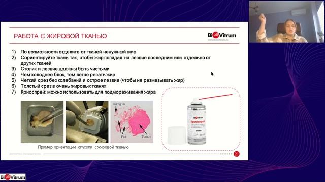 Вебинар по криотомии смотреть онлайн