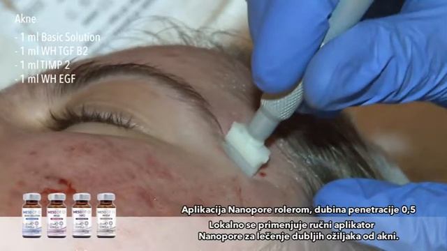 MEDI DERMA Angelica Maria Bouret RADIONICA смотреть онлайн