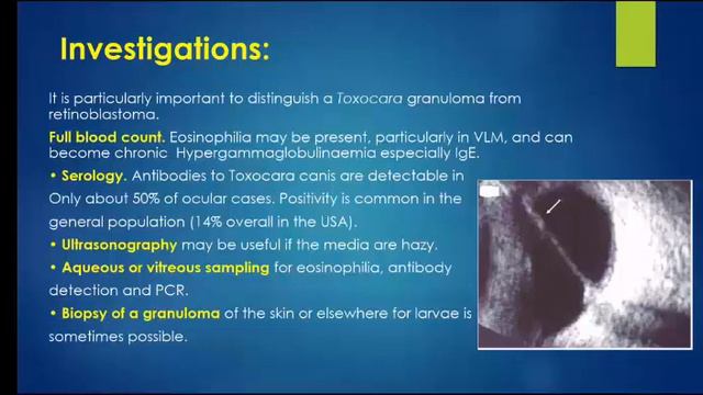Uveitis Part 3 смотреть онлайн