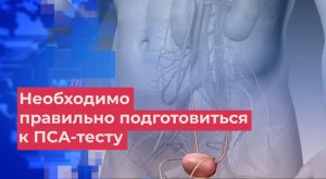 Урологи на видео объяснили, как правильно сдать анализ ПСА