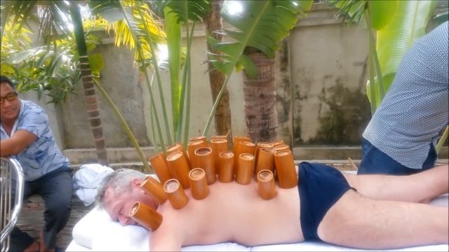 Лечение банками на Хайнане \\ Sanya, Hainan China смотреть онлайн