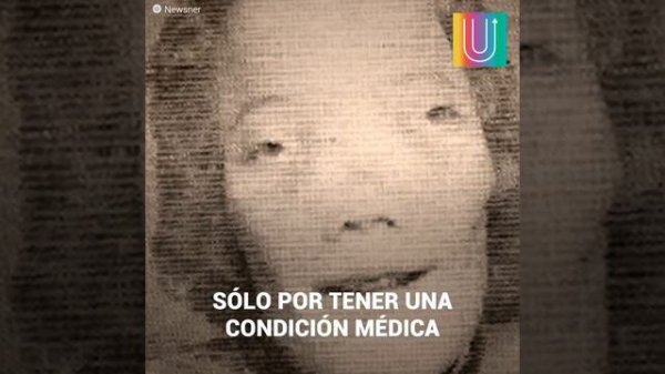 La misteriosa historia de Roy Lee Dennis y su rara enfermedad ósea