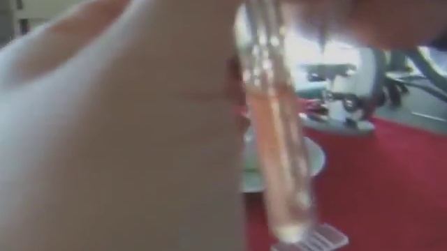 Подсчет эритроцитов смотреть онлайн