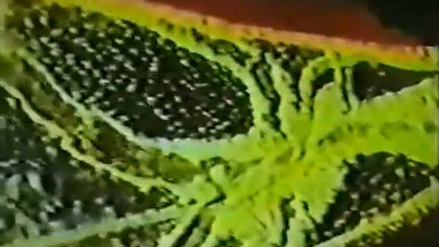 Движение лимфы смотреть онлайн